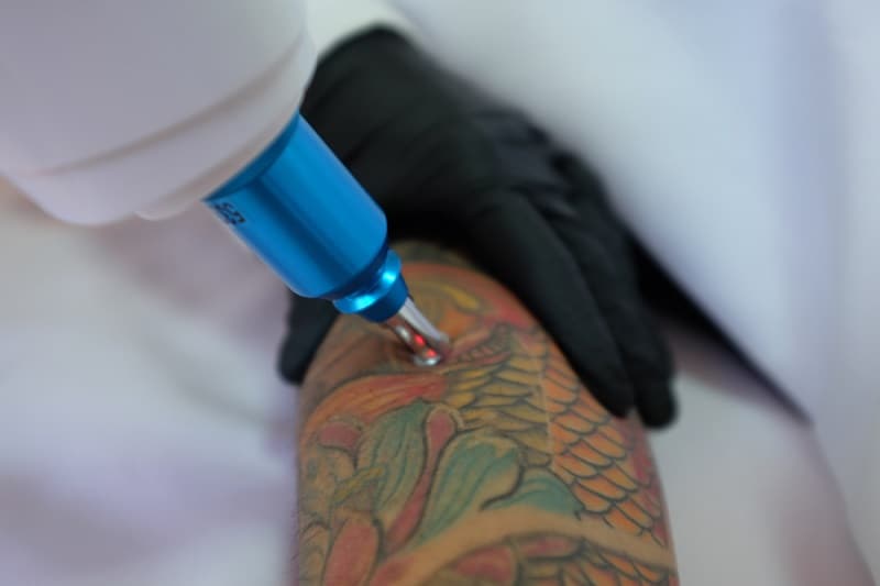 Lucid Q-PTP Laser Tattoo Removal Machine | Tattoo Removal Equipment