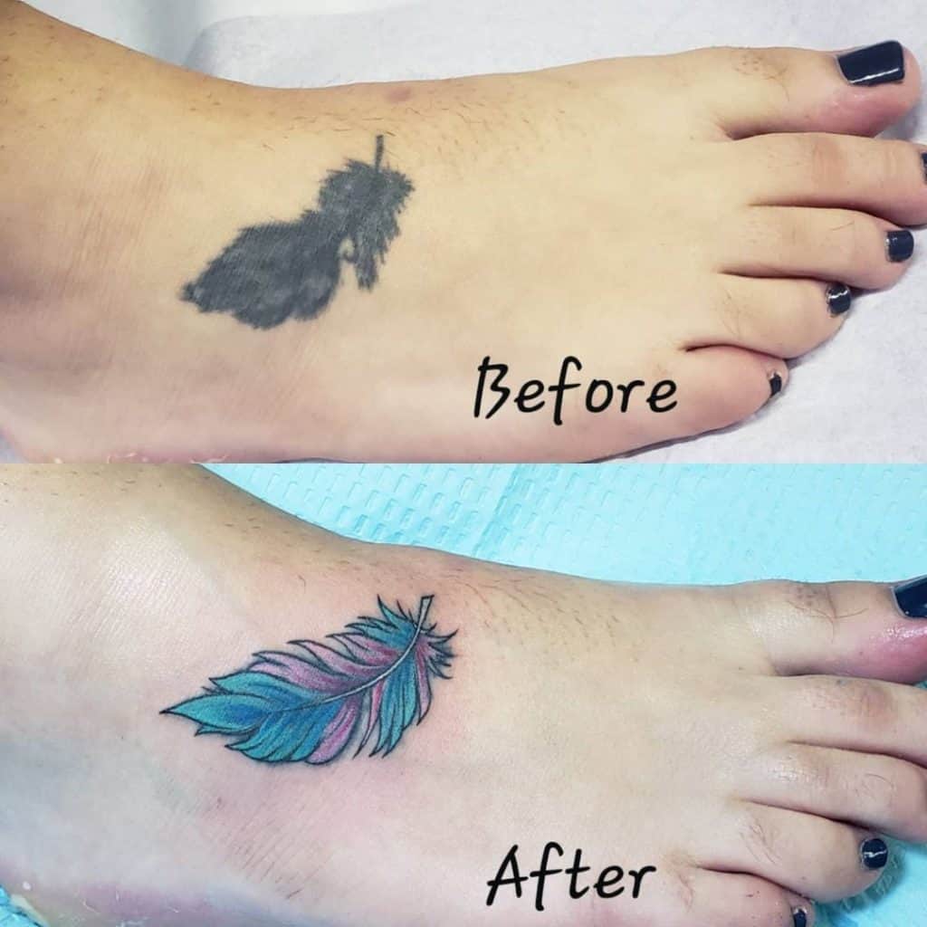 Laser Tattoo Removal Before and After: Ultimate Guide 2023 - Saved Tattoo