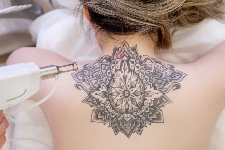 How To Fade a Tattoo: Effective Methods + How To Do It