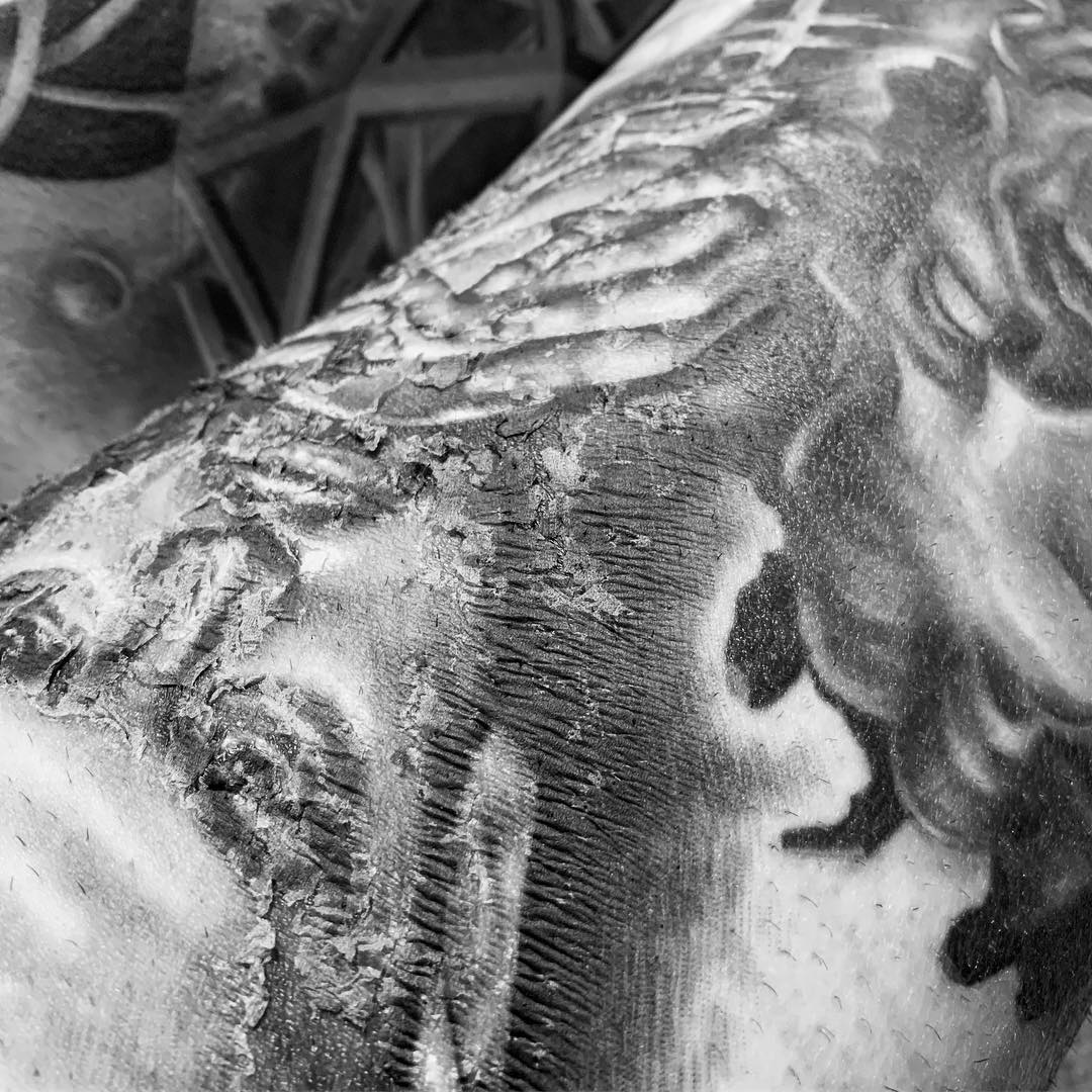 Tattoo Peeling Schorf