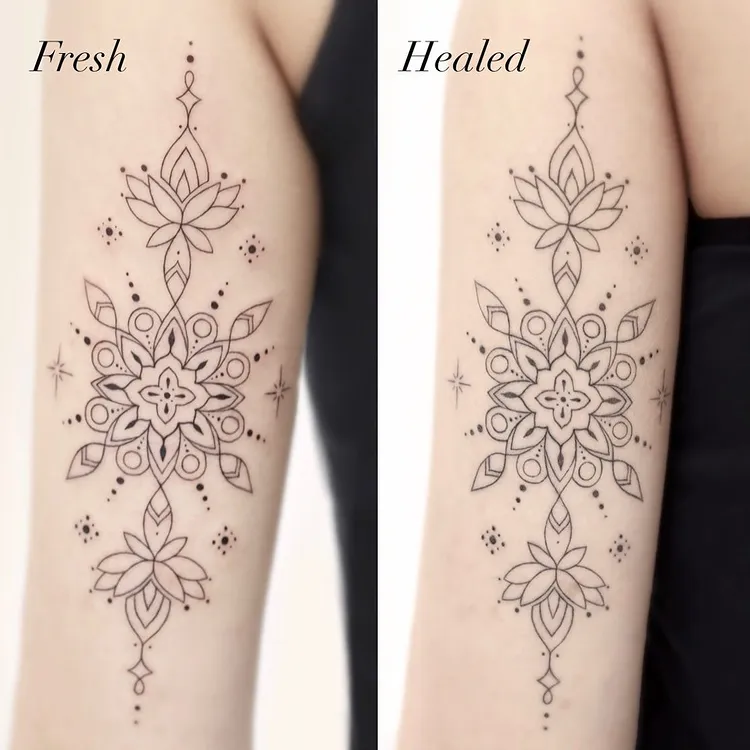 Vorher-Nachher-Fotos für das Tattoo-Peeling